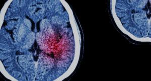 NICO Corp brain image