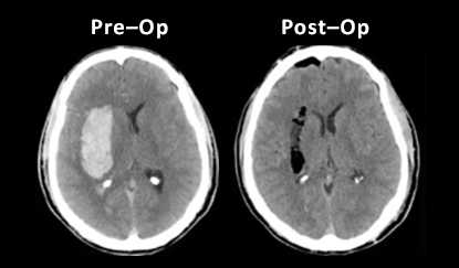 clinical evidence-for-ICH-evaluation-NICO