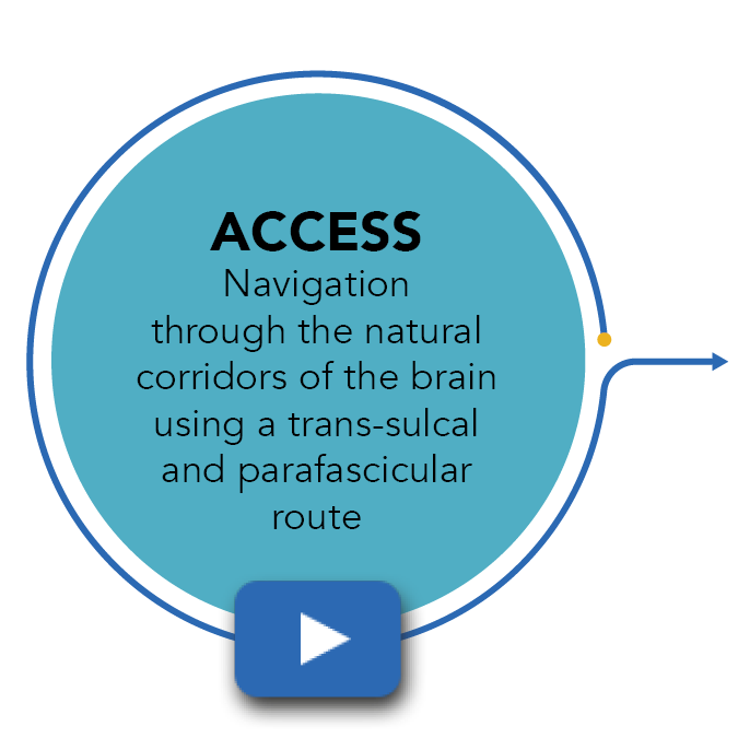 Watch NICO Corporation's ACCESS Video